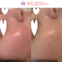 画像556