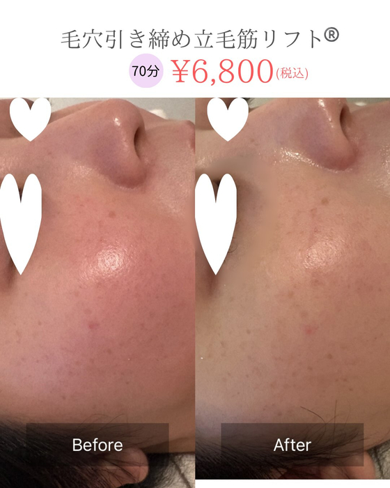 画像556
