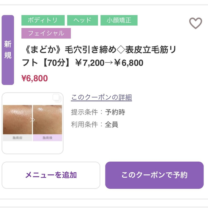画像561
